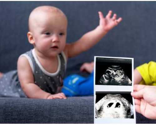 长沙供卵哪里便宜,做长沙三代试管婴儿成功率高吗?只需做好这五点!